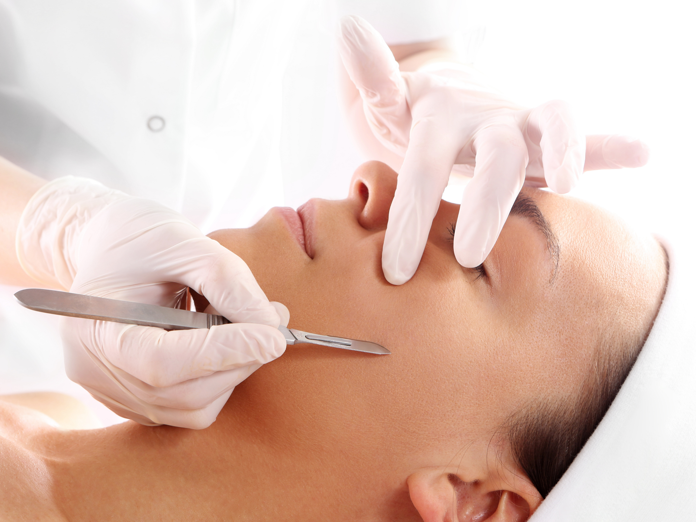 woman receiving a professional dermaplaning treatment from someone with gloved hands and a scalpel
